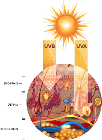 UV radiation
